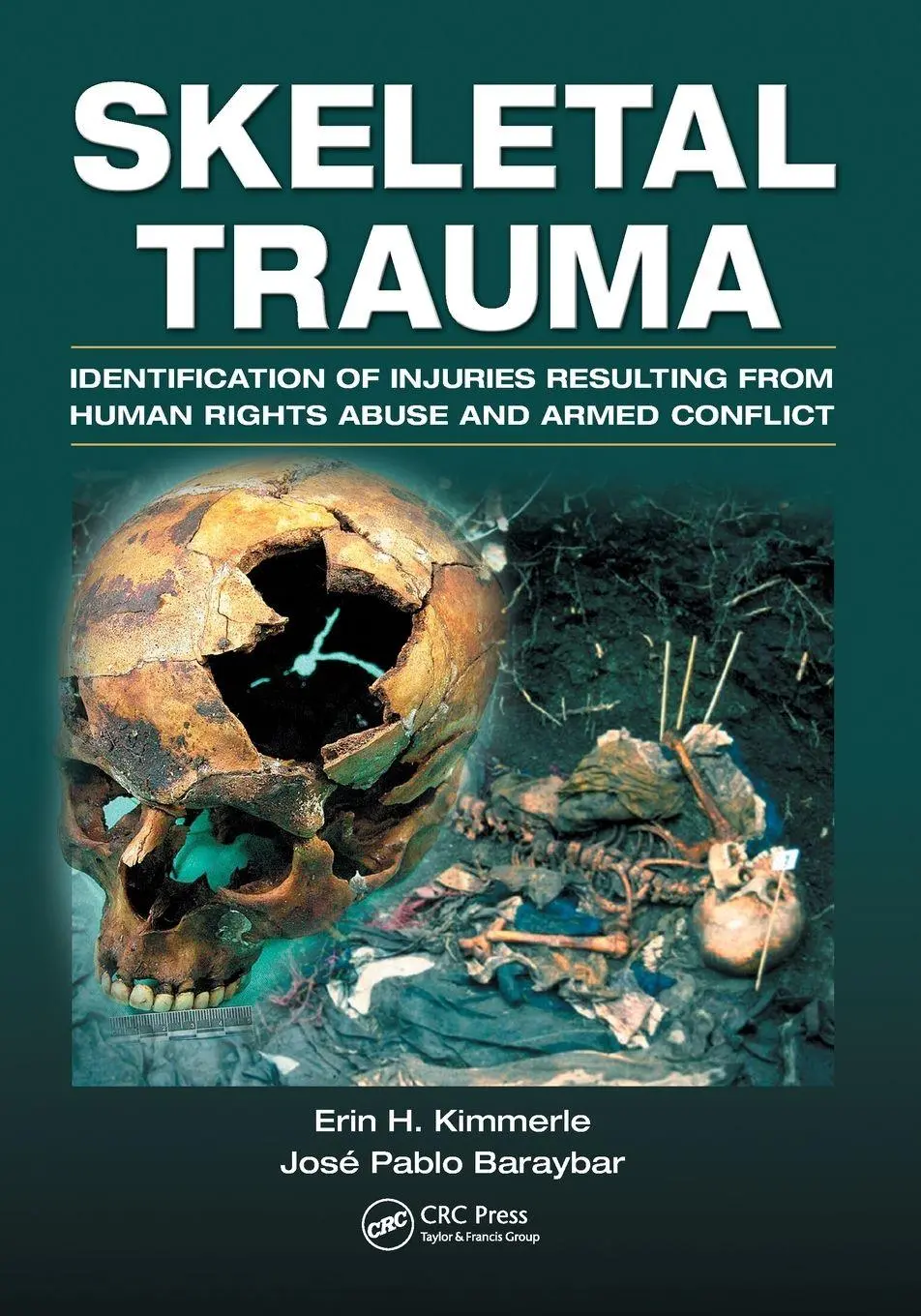 Skeletal Trauma Erin H. Kimmerle (U. A.) Taschenbuch Englisch 2024 CRC Press-image
