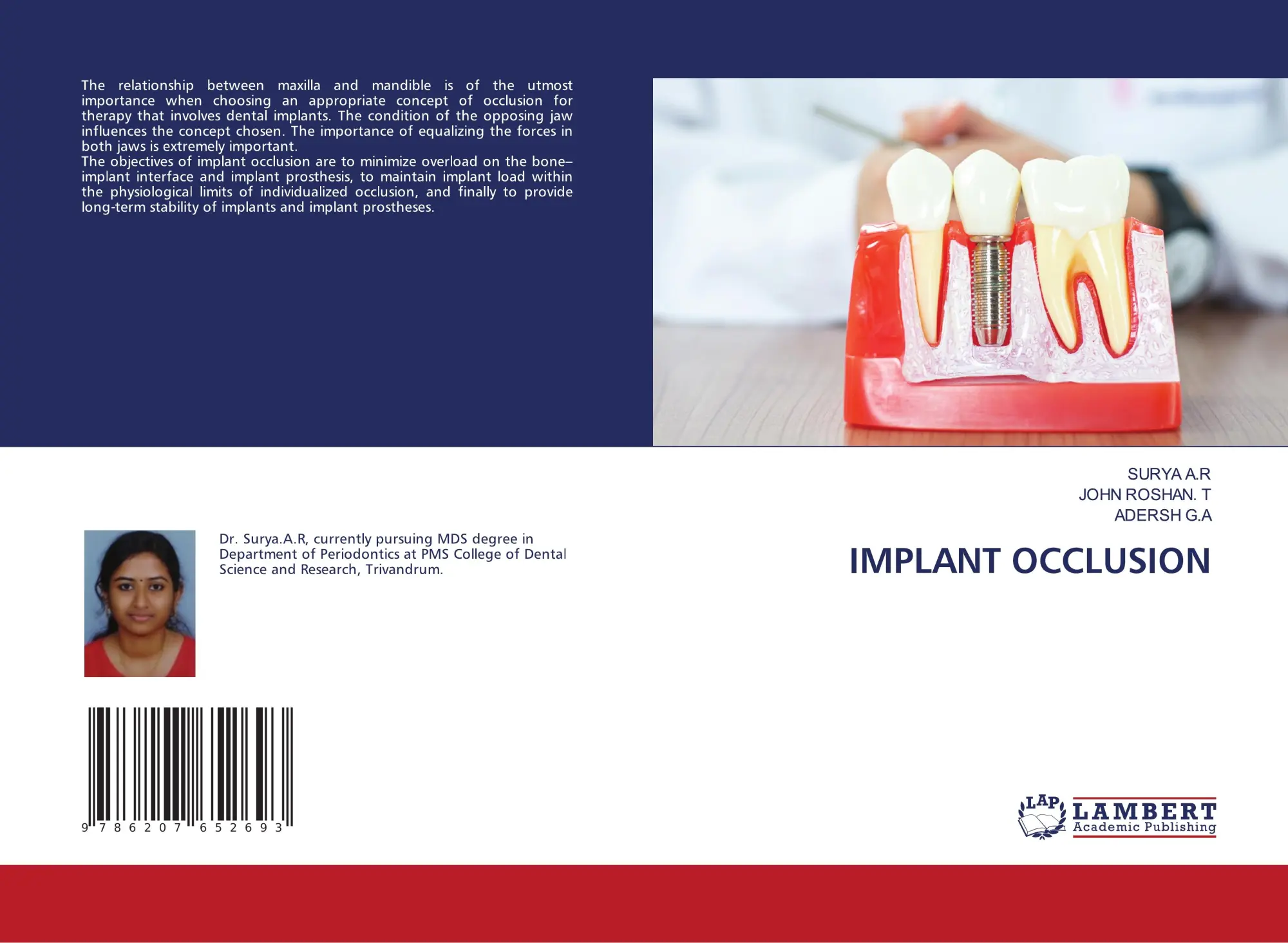 Implant Occlusion Surya A. R (U. A.) Taschenbuch Englisch 2024 Ean 9786207652693-image