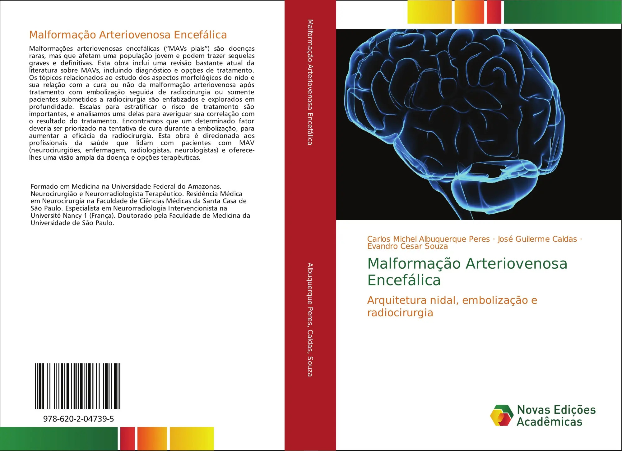 Malformação Arteriovenosa Encefálica / Arquitetura nidal, embolização e radiocirurgia - Albuquerque Peres, Carlos Michel