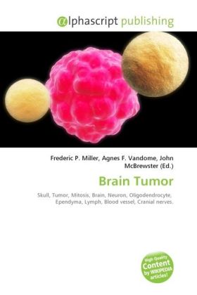 Brain Tumor / Frederic P. Miller (u. a.) / Taschenbuch / Englisch / Alphascript Publishing / EAN 9786130298104 - Miller, Frederic P.