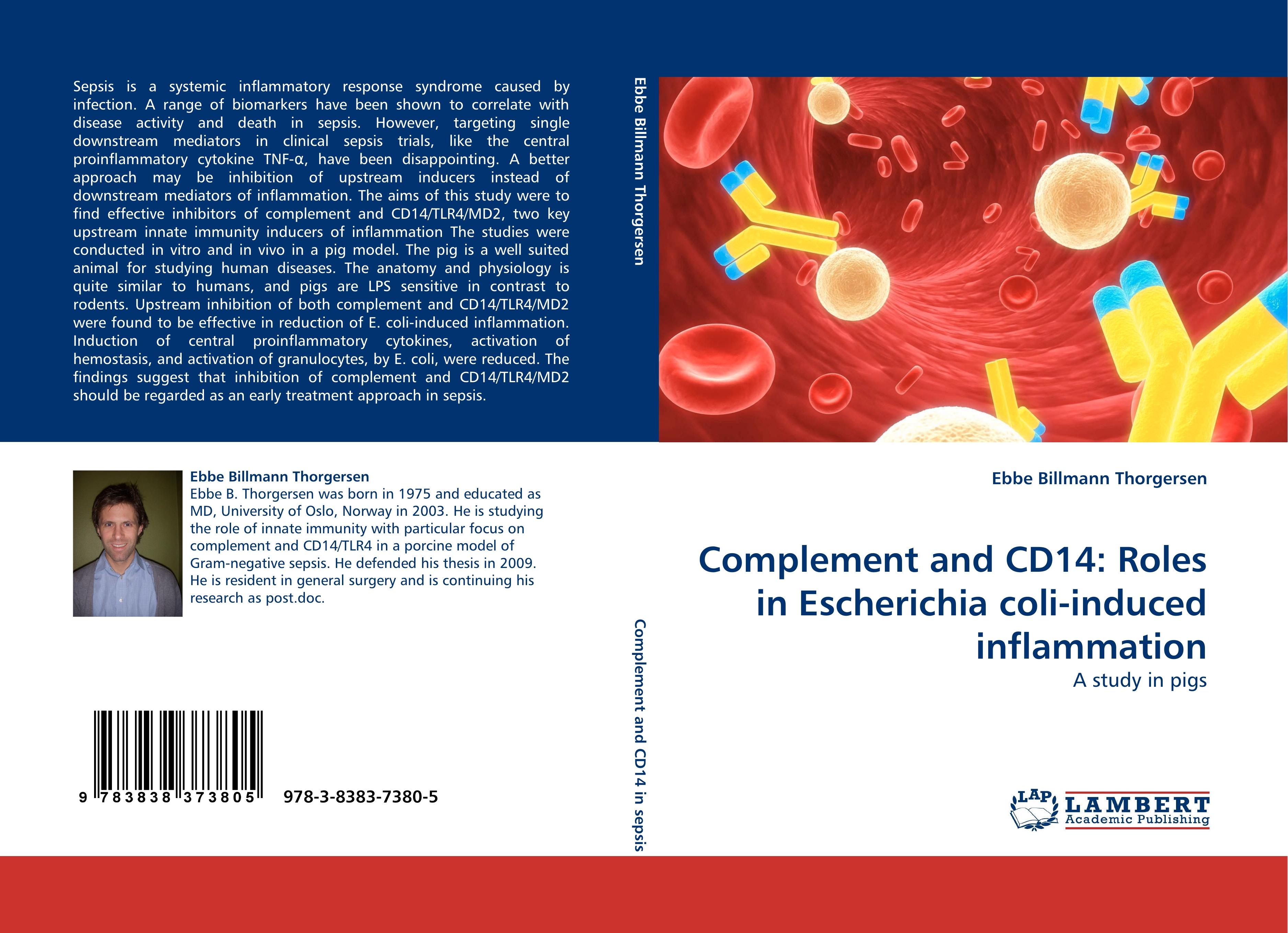 Complement and CD14: Roles in Escherichia coli-induced inflammation / A study in pigs / Ebbe Billmann Thorgersen / Taschenbuch / Paperback / 124 S. / Englisch / 2010 / LAP LAMBERT Academic Publishing - Thorgersen, Ebbe Billmann