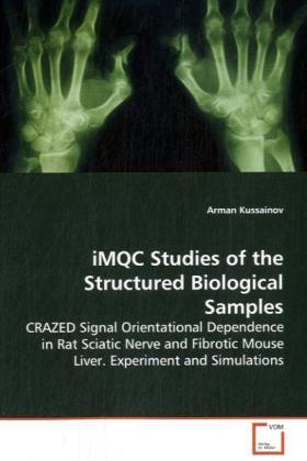 iMQC Studies of the Structured Biological Samples / CRAZED Signal Orientational Dependence in Rat Sciatic Nerve and Fibrotic Mouse Liver. Experiment and Simulations / Arman Kussainov / Taschenbuch - Kussainov, Arman