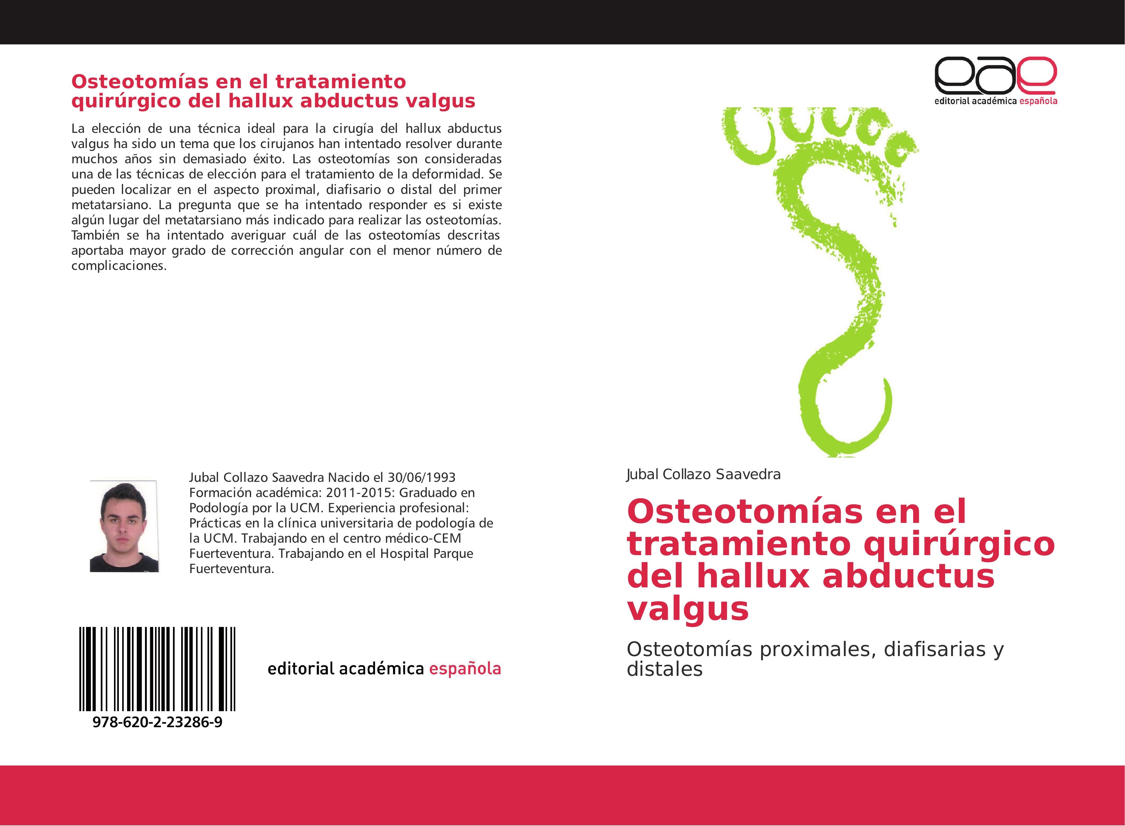 Osteotomías en el tratamiento quirúrgico del hallux abductus valgus / Osteotomías proximales, diafisarias y distales / Jubal Collazo Saavedra / Taschenbuch / Paperback / 52 S. / Spanisch / 2017 - Collazo Saavedra, Jubal