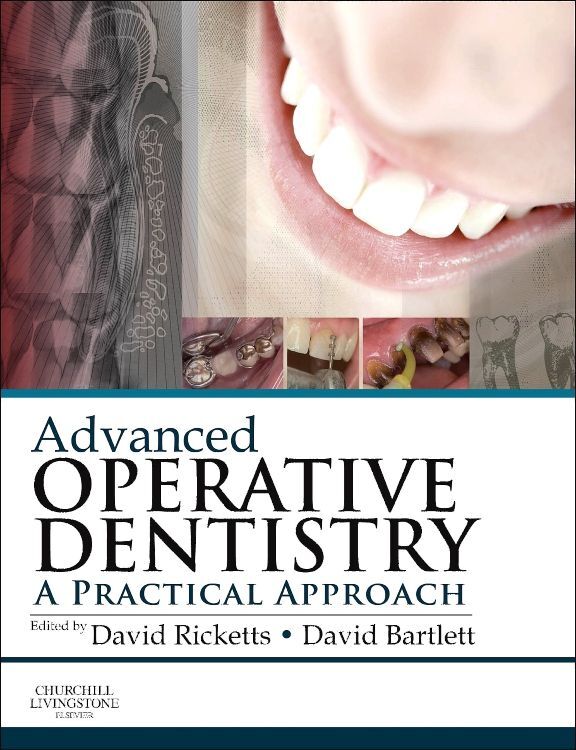 Advanced Operative Dentistry / A Practical Approach / David Ricketts (u. a.) / Taschenbuch / Englisch / Churchill Livingstone / EAN 9780702055386 - Ricketts, David